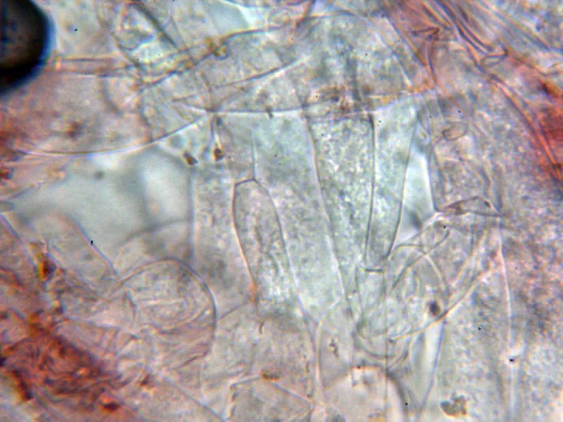 Agaricus iodosmus 10 - Hifas subpellis